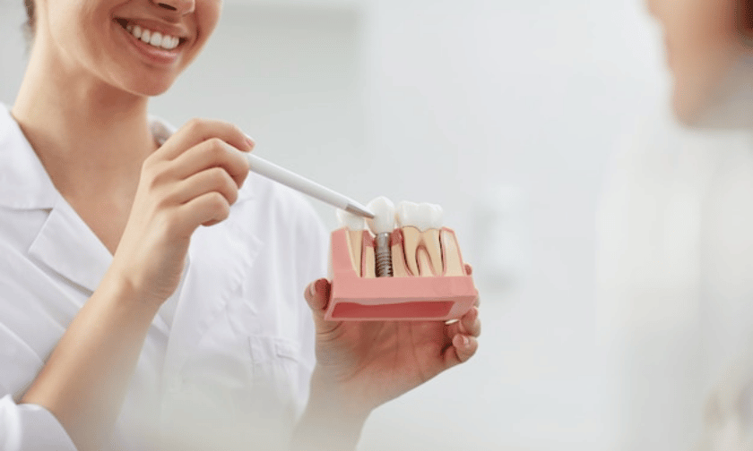 Signs You Might Need Dental Implants