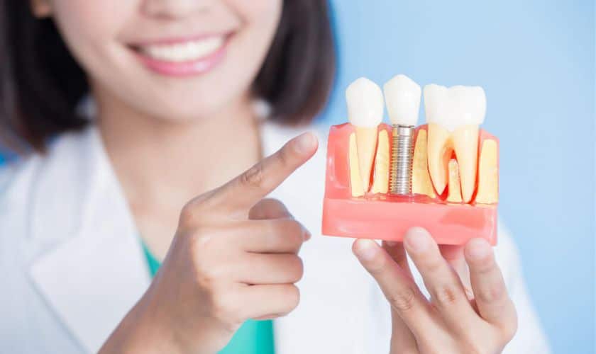 Dental Implants VS. Bridges: Making The Right Choice For Your Smile