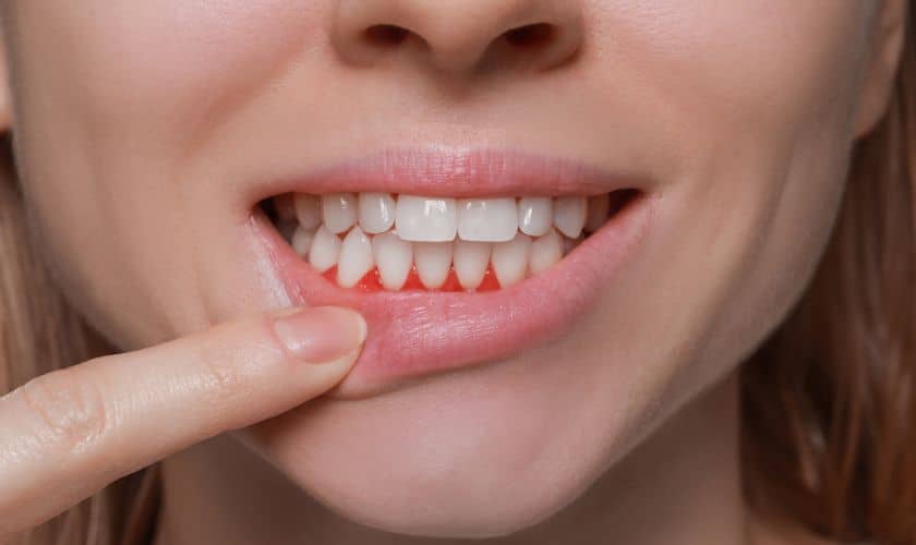 Understanding the Long-Term Implications of Neglected Gum Disease