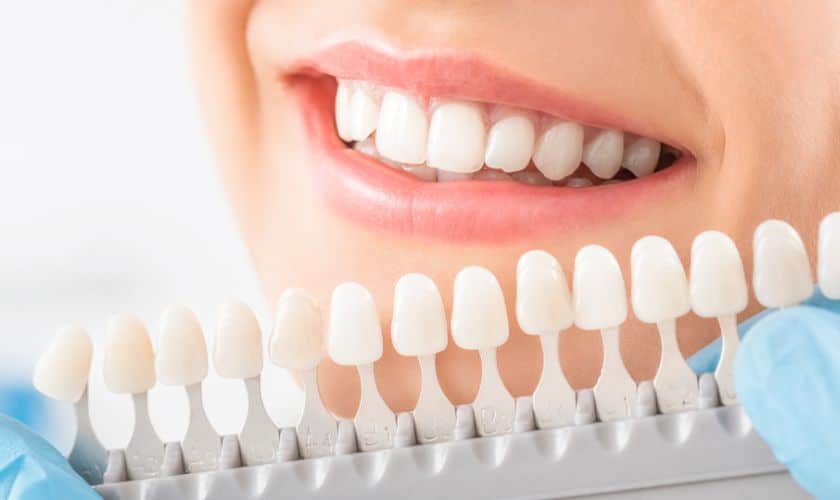 How to Boost Your Confidence with White Teeth